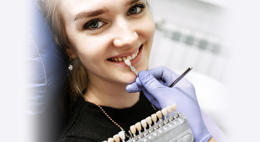 Essential Information You Must Have Before Getting Dental Veneers