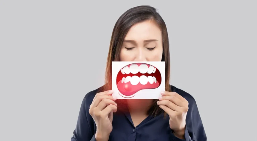 What Is Periodontal Treatment And When Do I Need It
